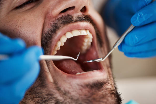 Best Dentist for Dental Trauma  in Clinton, UT